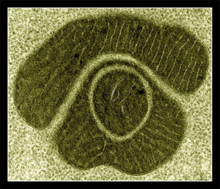 Просвечивающий микроскоп, увеличение 30 000. Энергетические заводики-митохондрии есть в каждой живой клетке. Такую необычную форму они приняли в яйцеклетке мухи-дрозофилы. Первая премия «Micro-Art» на Микроскопическом конгрессе в Венгрии, 2015 г.
